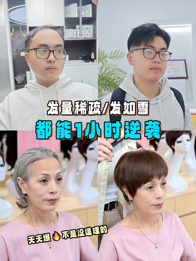 寧波買假發(fā) \