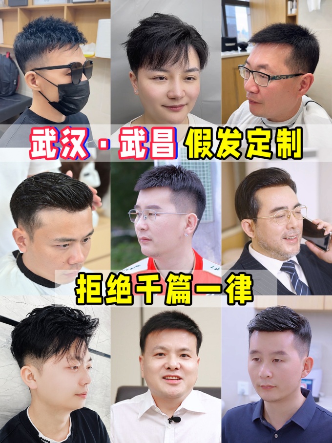 m發(fā)際線,謝頂不用愁,武漢假發(fā) \