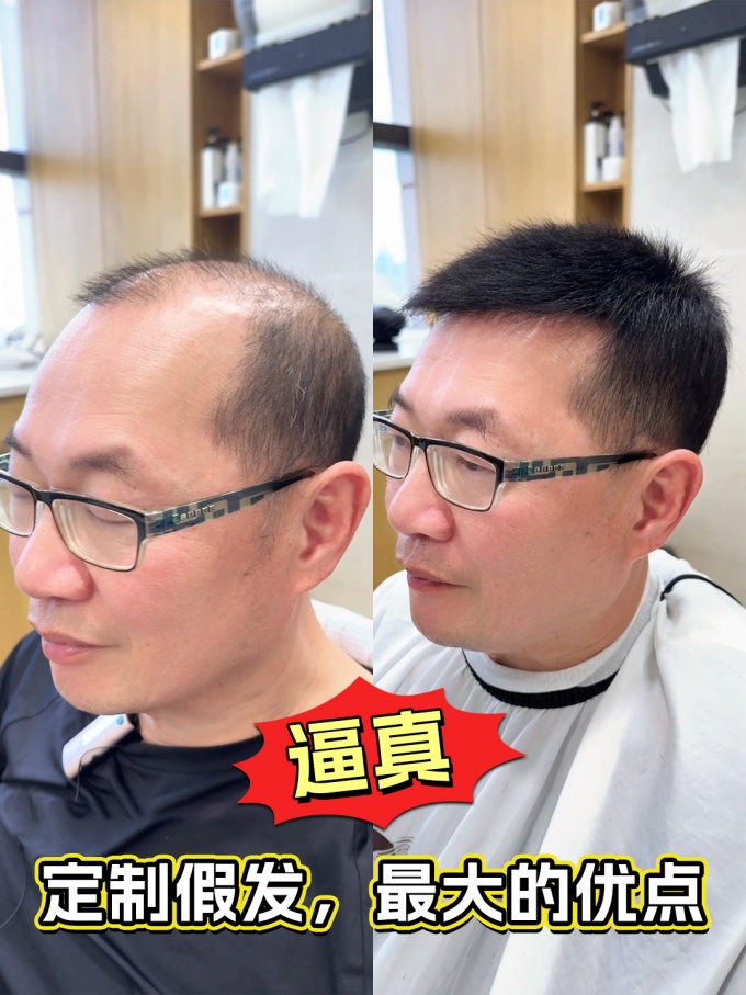 深圳買假發(fā)去哪里,福田假發(fā)店 \