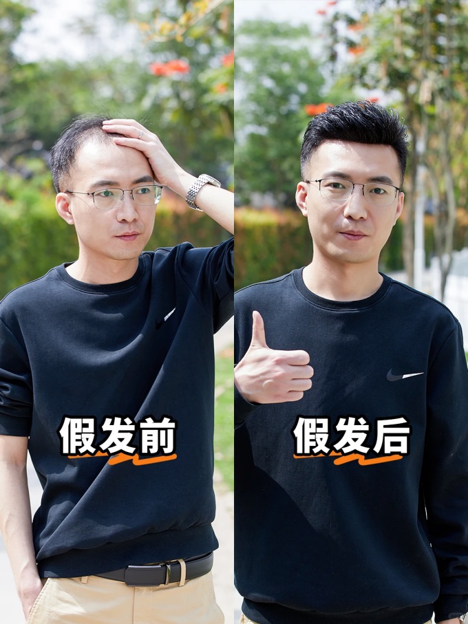 謝頂男生,定制假發(fā) \