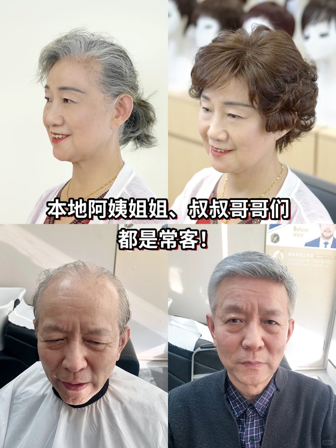 謝頂男生,定制假發(fā) \