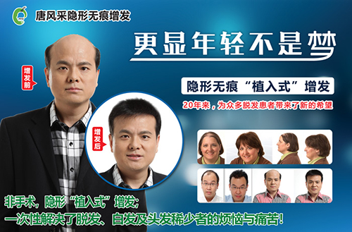 時(shí)光匆匆過，頭發(fā)脫了禿了怎么辦？