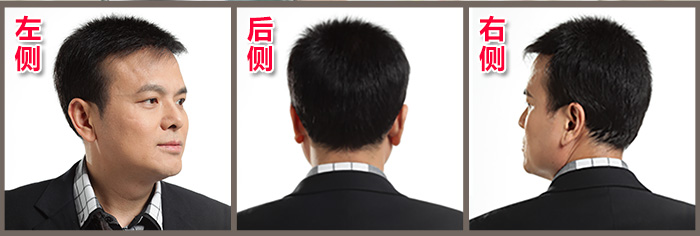 北京織發(fā)補發(fā)哪家好？怎么收費？