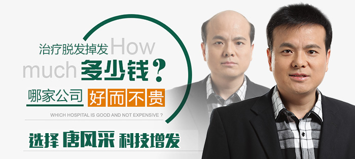 西寧買隱形假發(fā)哪家好？多少錢才能買到？